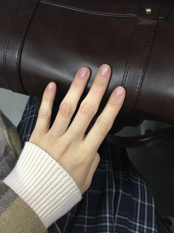 女孩子手长得丑关节大且扭曲之类的像枯枝一样是什么体验