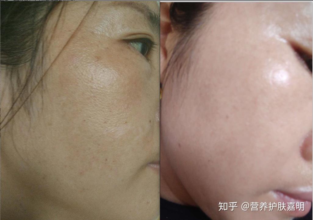 女孩子面色蜡黄暗沉怎么办