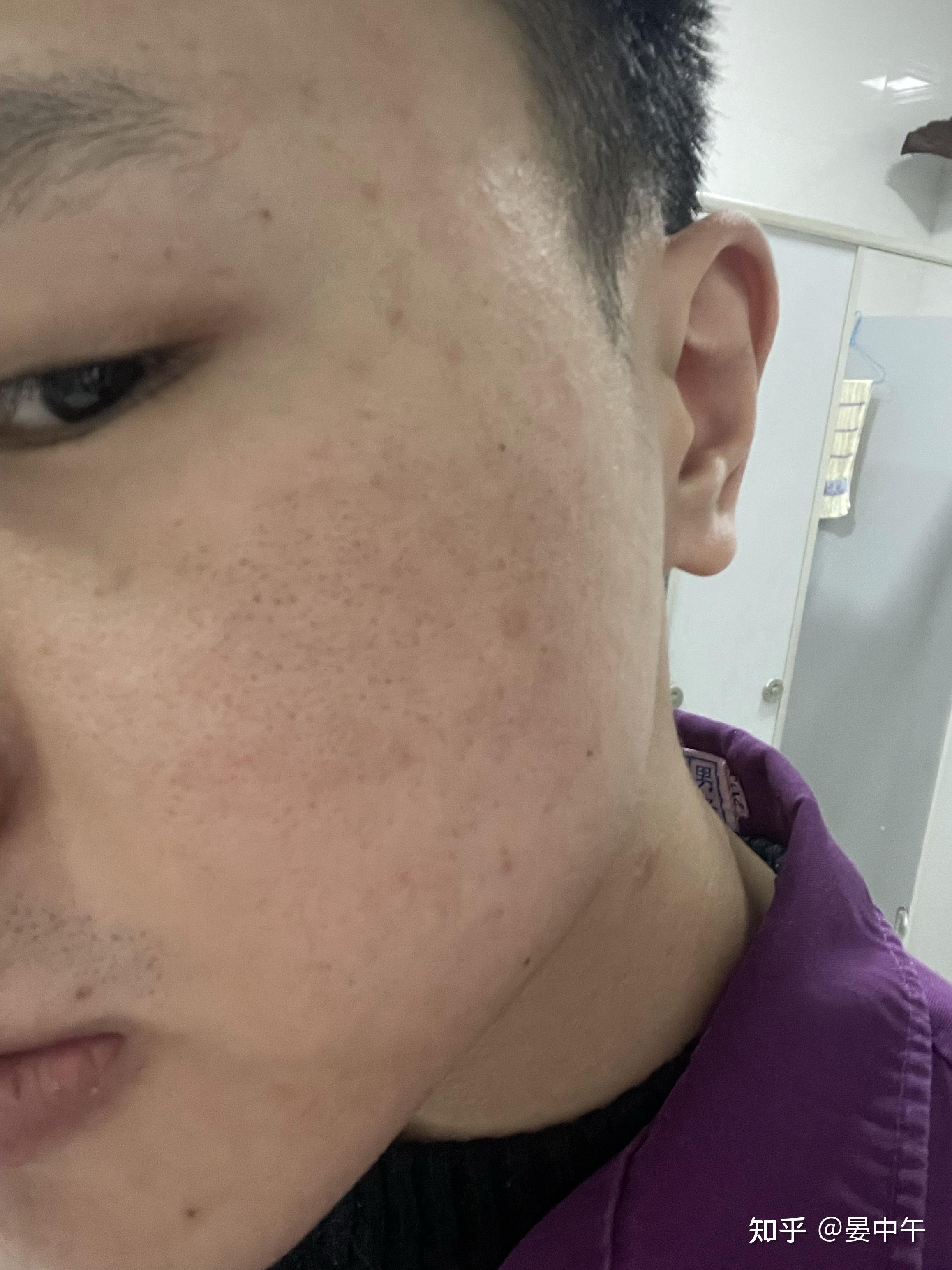 点阵激光色沉 - 知乎