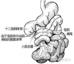 肠扭转发病时的症状是什么样的？