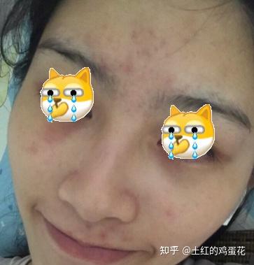 我经常熬夜,皮肤越来越差了,所以想入手一款对熬夜有效地面膜,请问谁