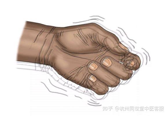 手抖是什么病的征兆？ - 知乎