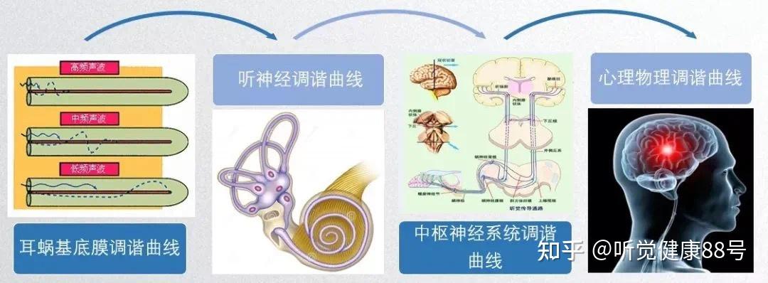 什么是听神经的调谐曲线？ - 知乎