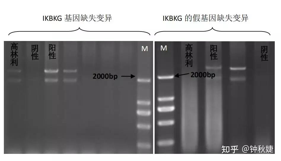 基因缺失图片