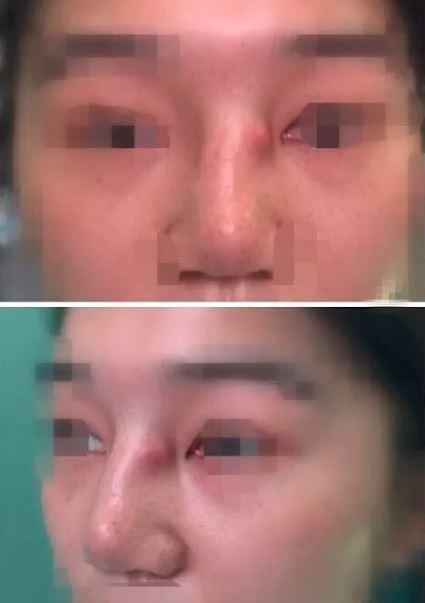 说说我认识的鼻综合 知乎