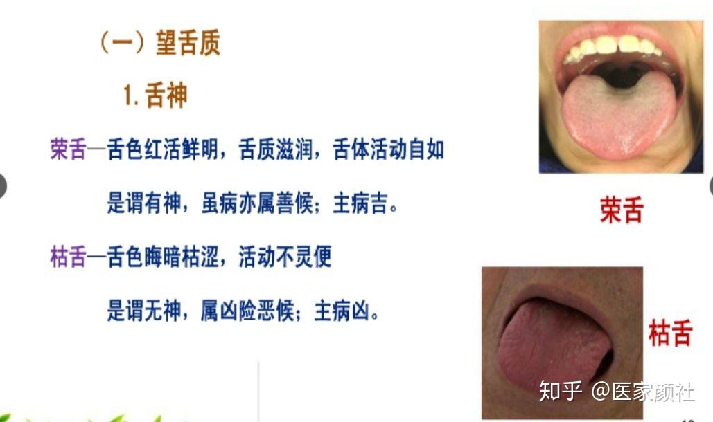 如何通过舌苔来判断身体健康与否?最全舌像来了,一分钟教你学会所有舌像! - 知乎