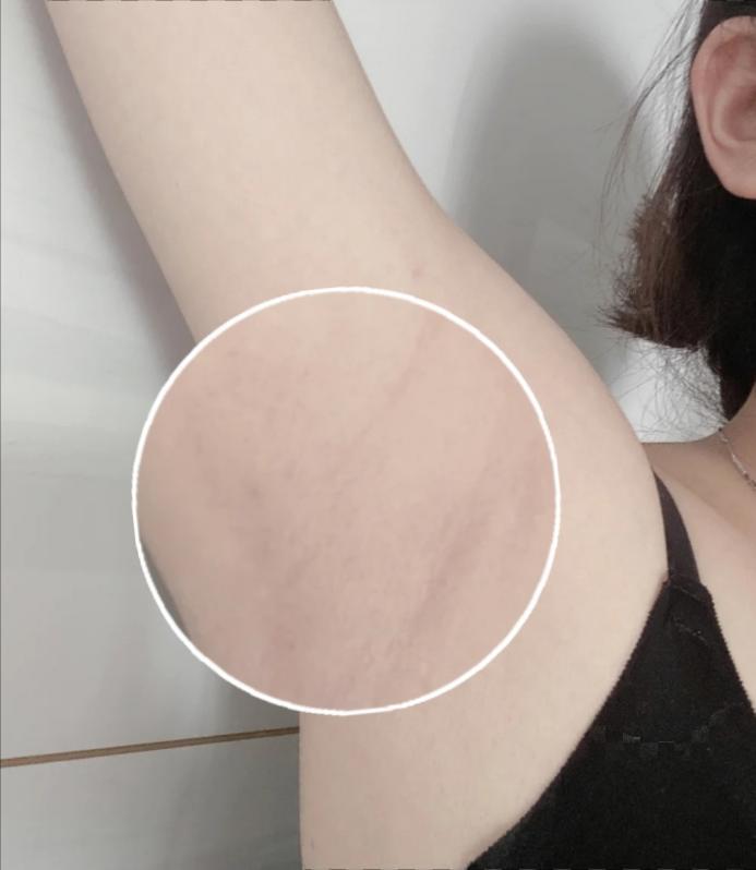 再给大家看看我的咯吱窝,光滑得我想在上面滑滑梯哈哈这是坚持用了一