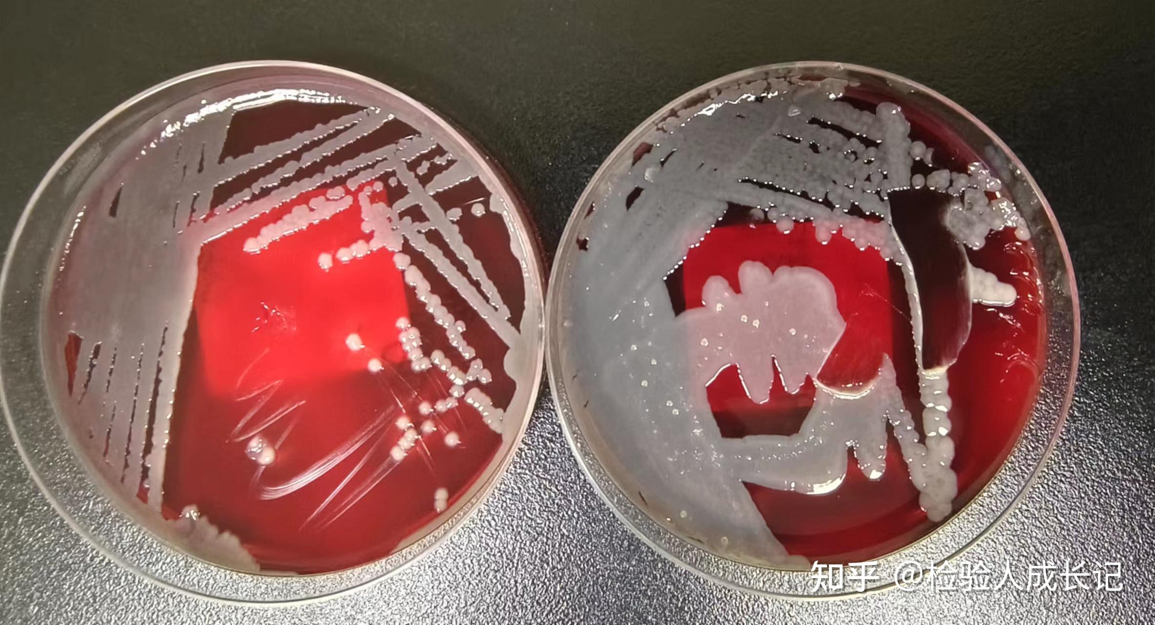 检验规培成长记-微生物检验之培养基菌落的观察 - 知乎