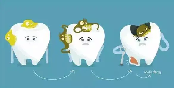 牙不疼就代表没病么?这些牙齿保健误区需注意