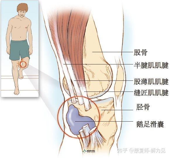 股内侧肌疼痛图片