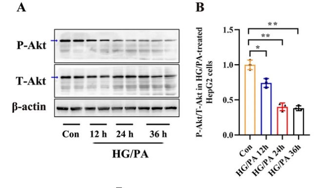 云序客户if83血清eccdna测序助力t2dm糖尿病生物标志物新发现
