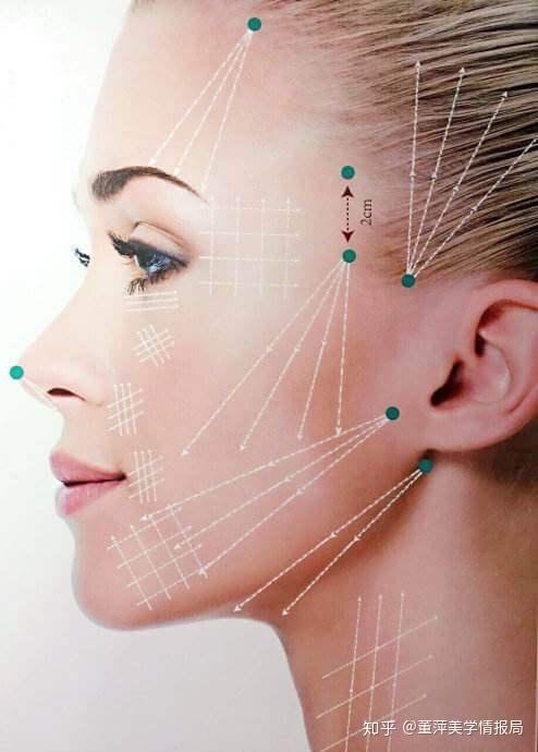 线雕使用的ppdo线根据规格不同,分为大v线和小v线两种