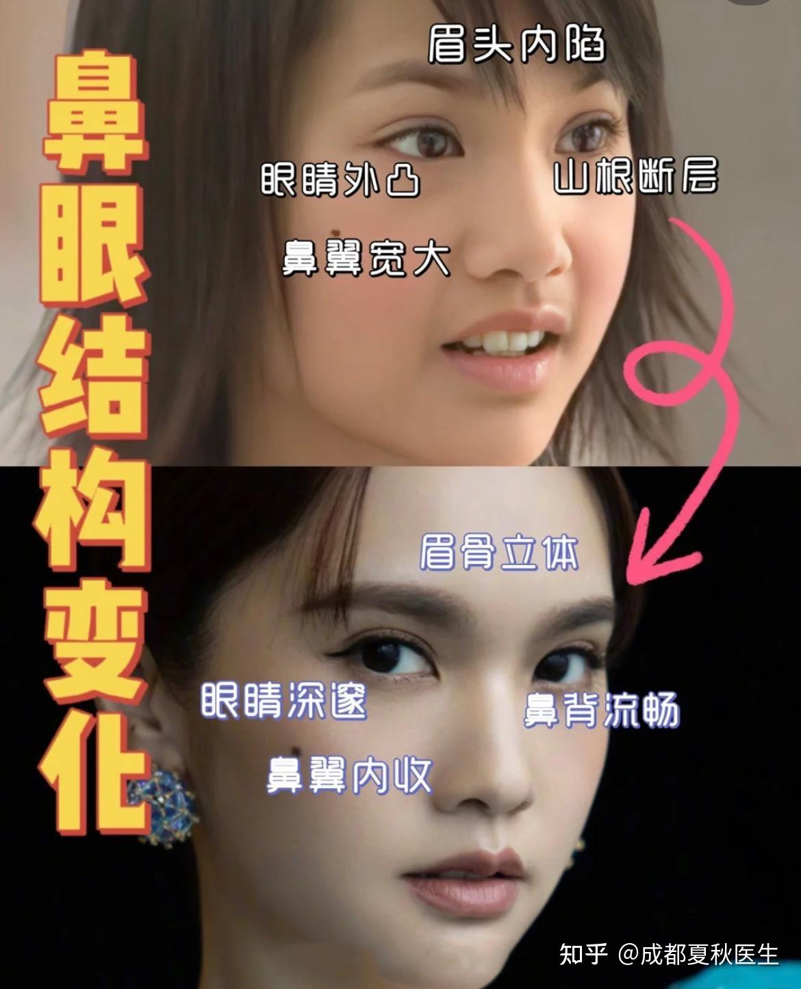 眉骨固定——杨丞琳高级感的核心点! - 知乎