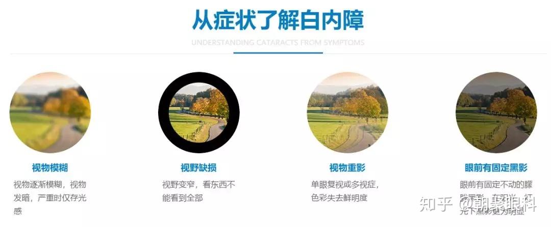 揭秘母乳喂养白内障这是一份献给母亲的礼物