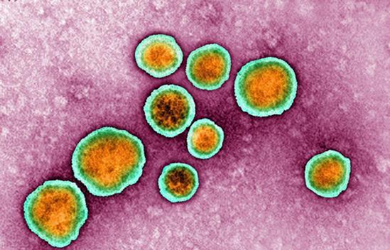 呼吸道合胞病毒(rsv)