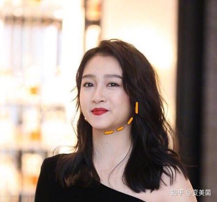 随着年龄的增长,胶原蛋白流失,肌肉组织松弛,就会出现腮帮子越来越宽