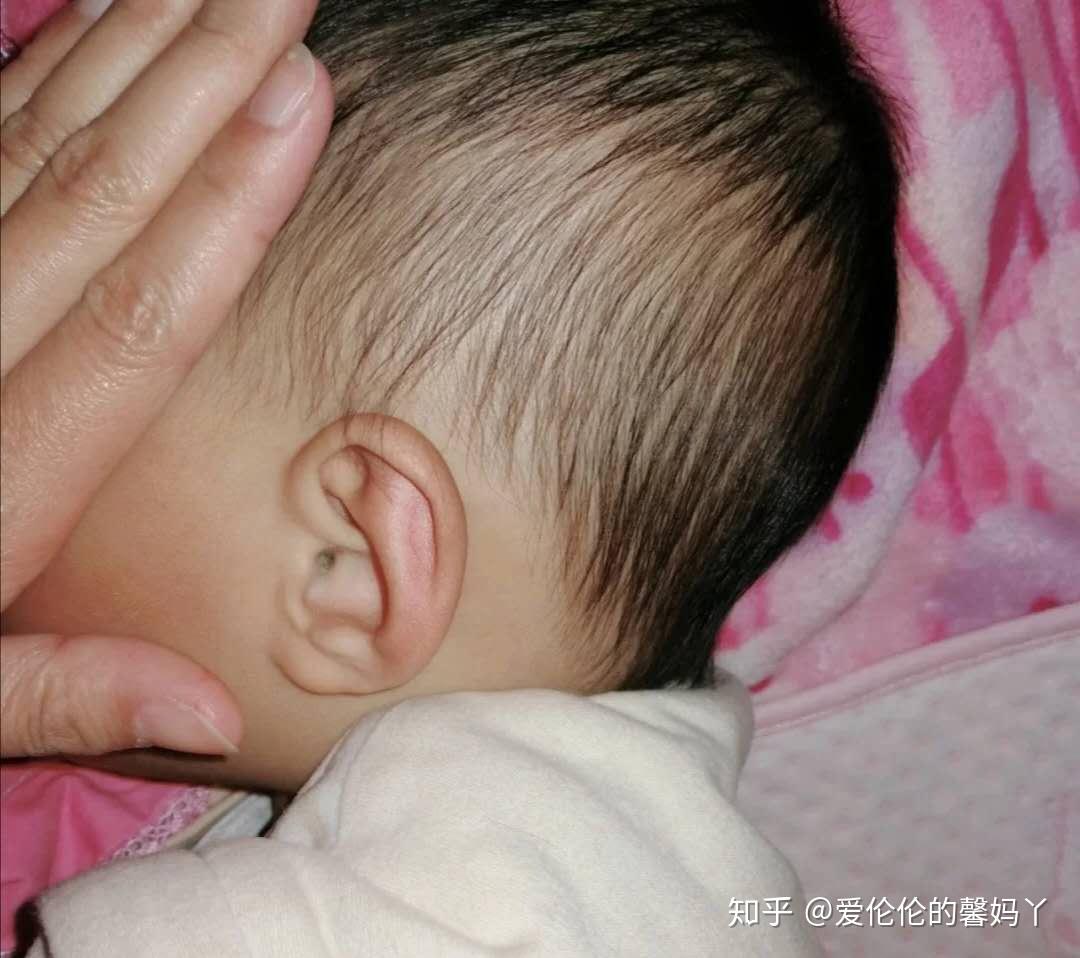 偏头?扁头?关于中国人爱给睡头型那些事 - 知乎