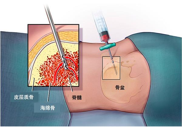 唇腺活检手术步骤图图片
