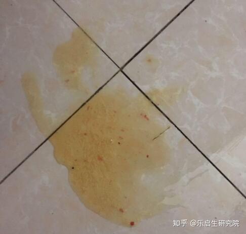 饿,反而觉得特别胀特别饱,好像听见胃里在冒气泡,吐出一堆黄疸水(哈哈