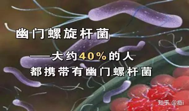 幽門螺桿菌感染後會有什麼影響如何避免感染這幾個知識點一定要記住