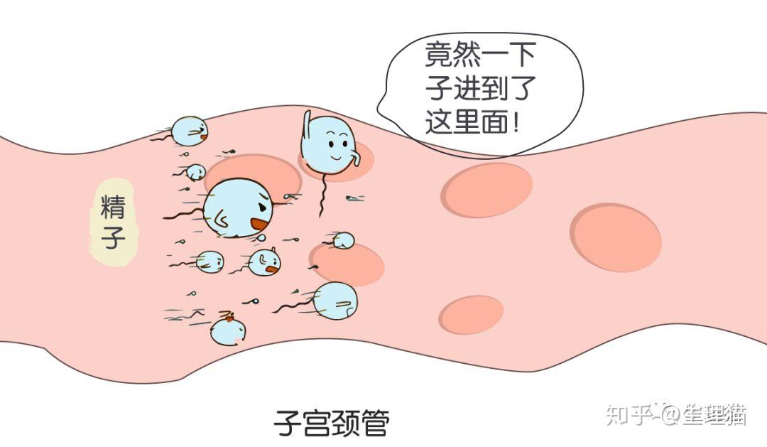 因为子宫颈管的内壁有很多的隐窝与裂隙(可以理解成坑坑洼洼),非常
