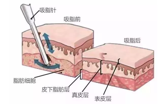 v2-b4bde412e0a2edcf56fbc1e7d9e9fccd_1440w.jpg