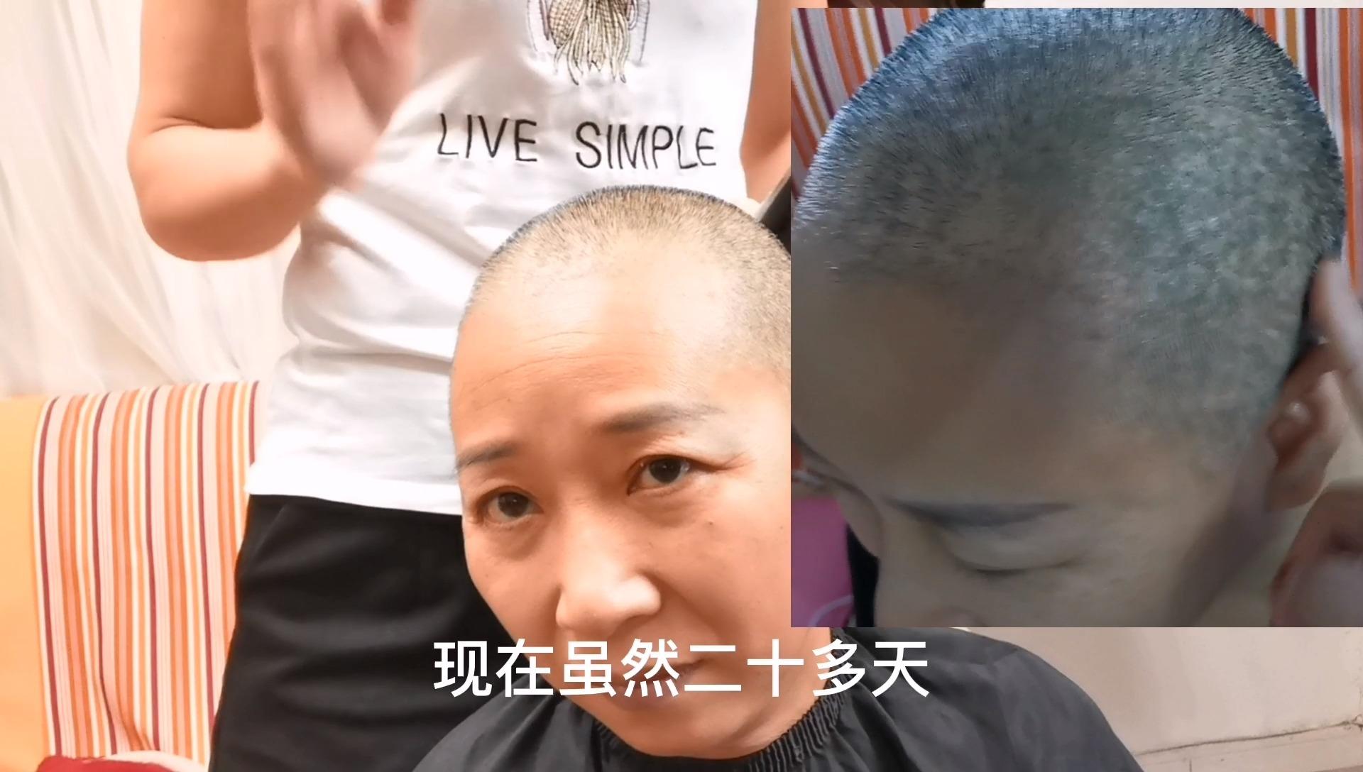 情况发布于 22 小时前 · 177 次播放光头头发光头女白头发少年白发人