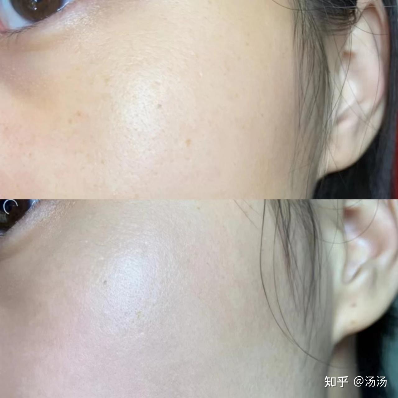 内服3个月胶原蛋白能对皮肤造成多大影响? - 知乎