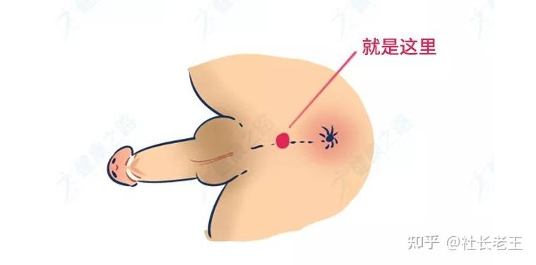 它位于阴囊和肛门之间的会阴内部,你在上厕所的时候,撒尿过程中常识把
