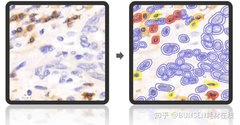 多重荧光免疫组化技术 AP-TIME 功能模块的详细介绍 - 知乎