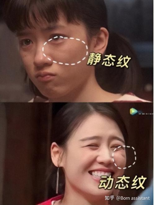 你脸上的印第安纹是静态的还是动态的