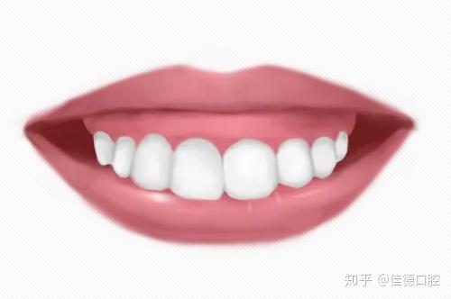 v2-b5c1093c0ff2157b40b6071b89585a73_r.jpg