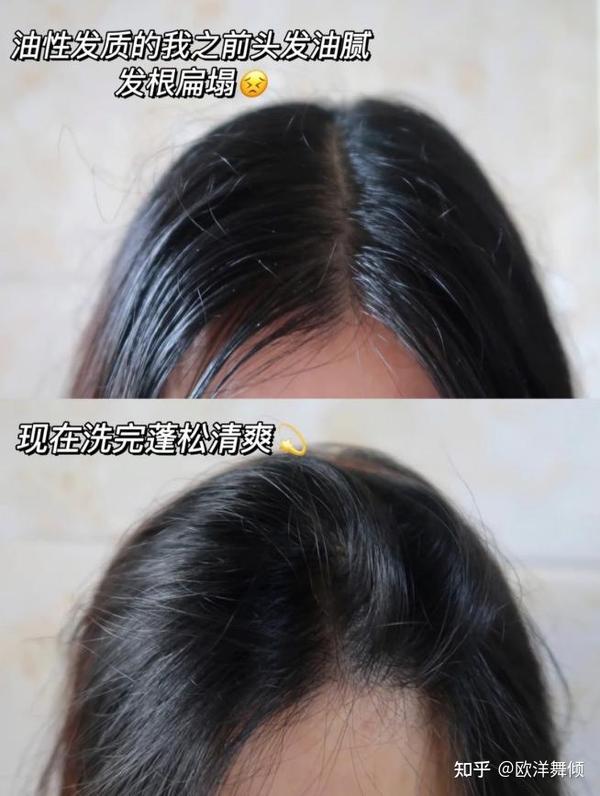 头痒难耐?头油扁塌?精致女生都会用的lzq赋活清爽洗发水,lzq洗发水还你蓬松秀发 - 知乎