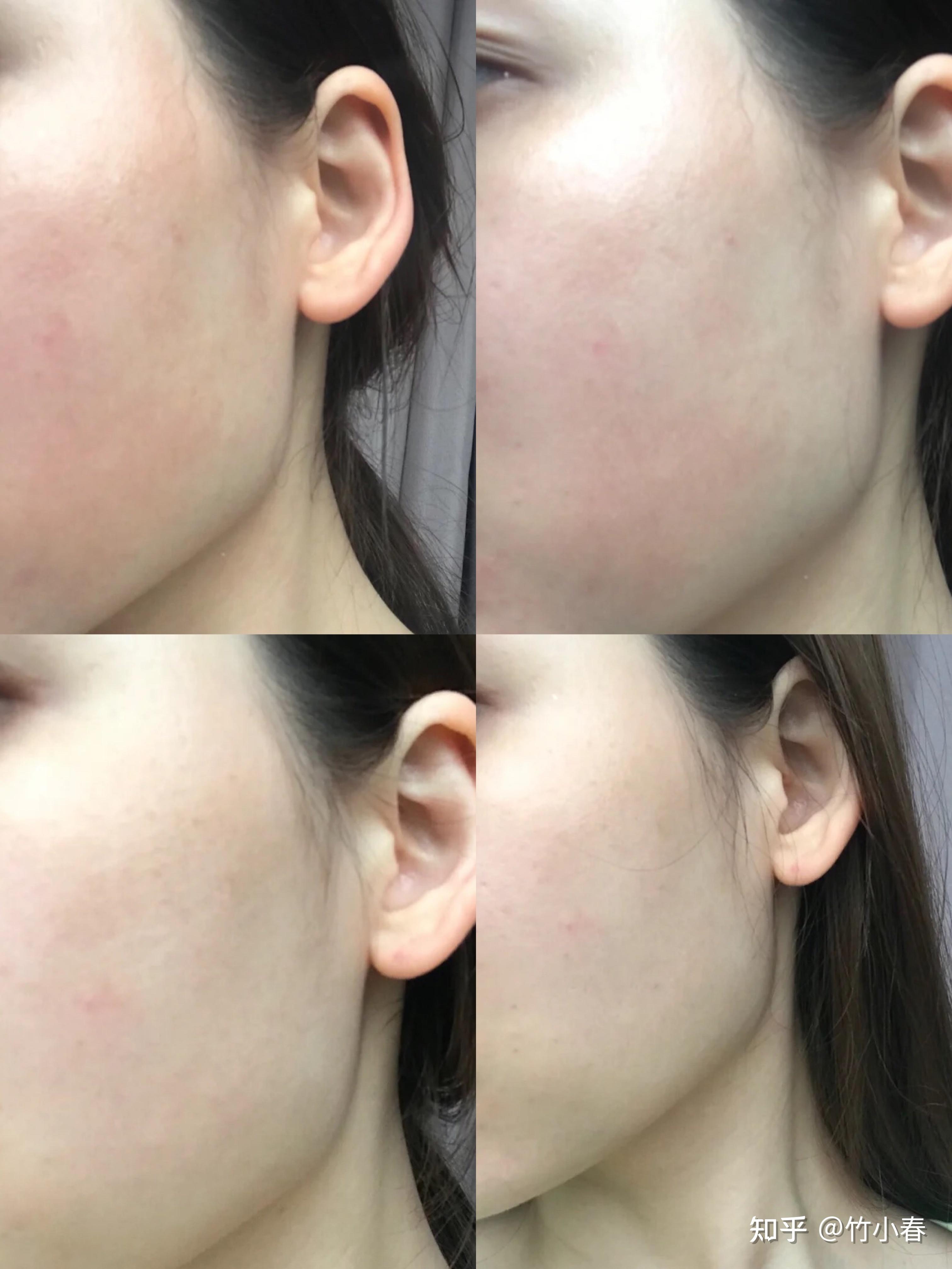 中间换了别的水乳,到换季敏感的时候,我脸上偶尔还会泛红,起小红点,就