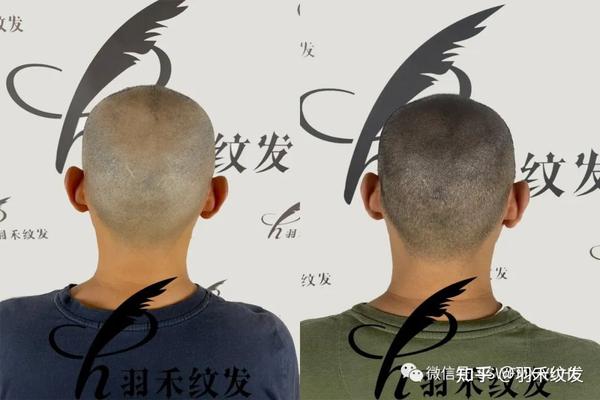 纹发可以模仿头发不同长度 - 知乎