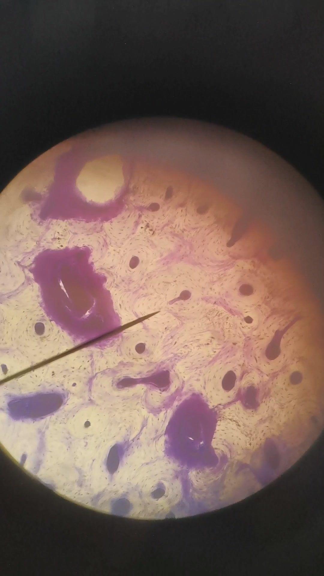 滴虫显微镜下图片
