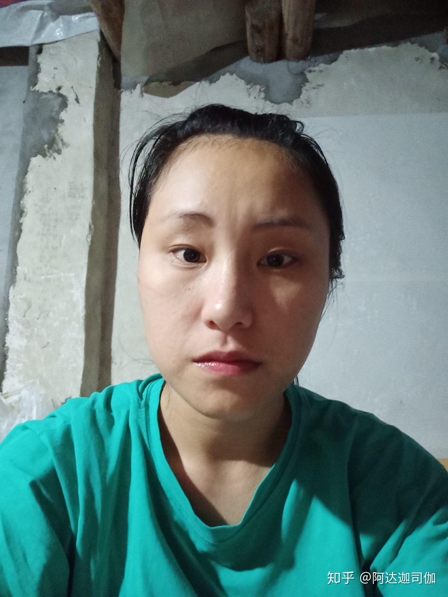 脸一大一小怎么拯救呢? - 知乎