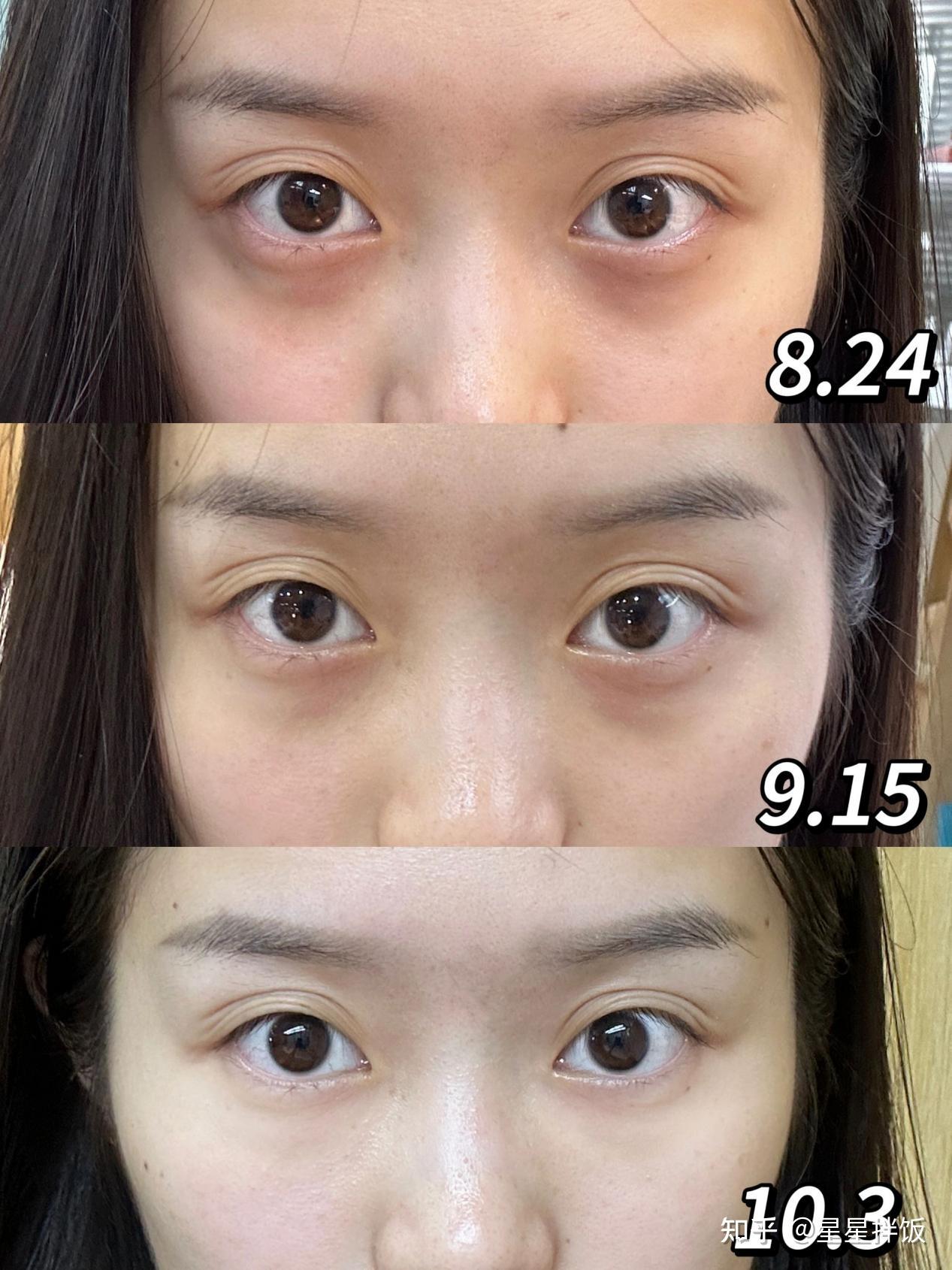 怎么让自己的脸变模糊 v2-b6e47467e6dfbf43aa4855b10bec6e13_r.jpg