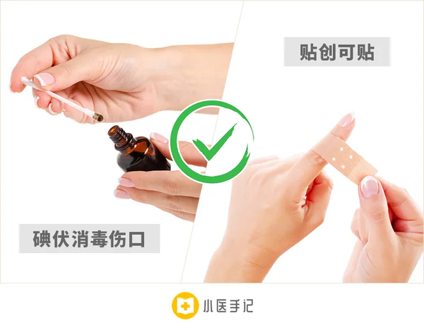 一分钟处理皮肤扎刺 - 知乎