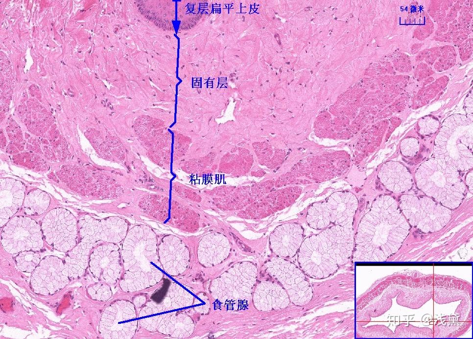 甲状腺切片图解图片