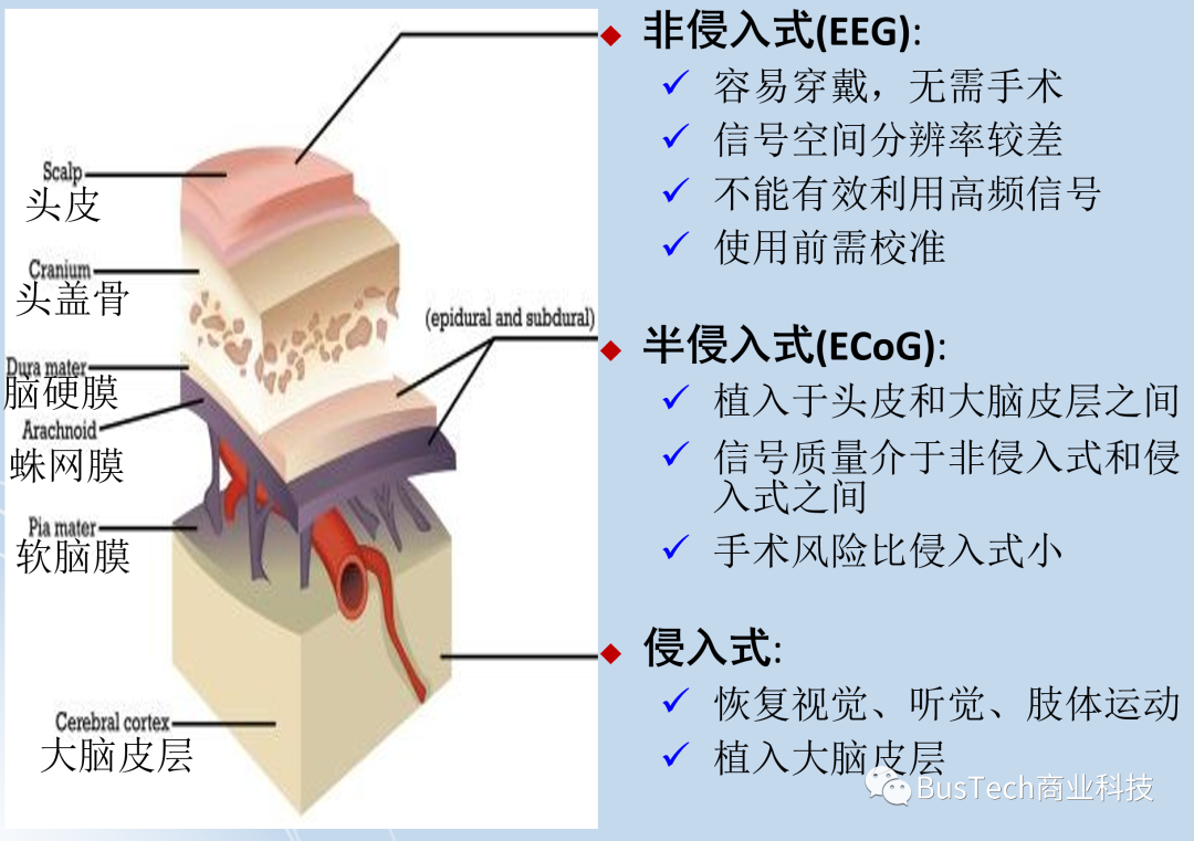 脑机接口的基本原理
