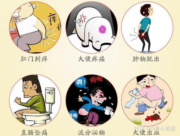 痔疮出血怎么治疗方法 - 知乎