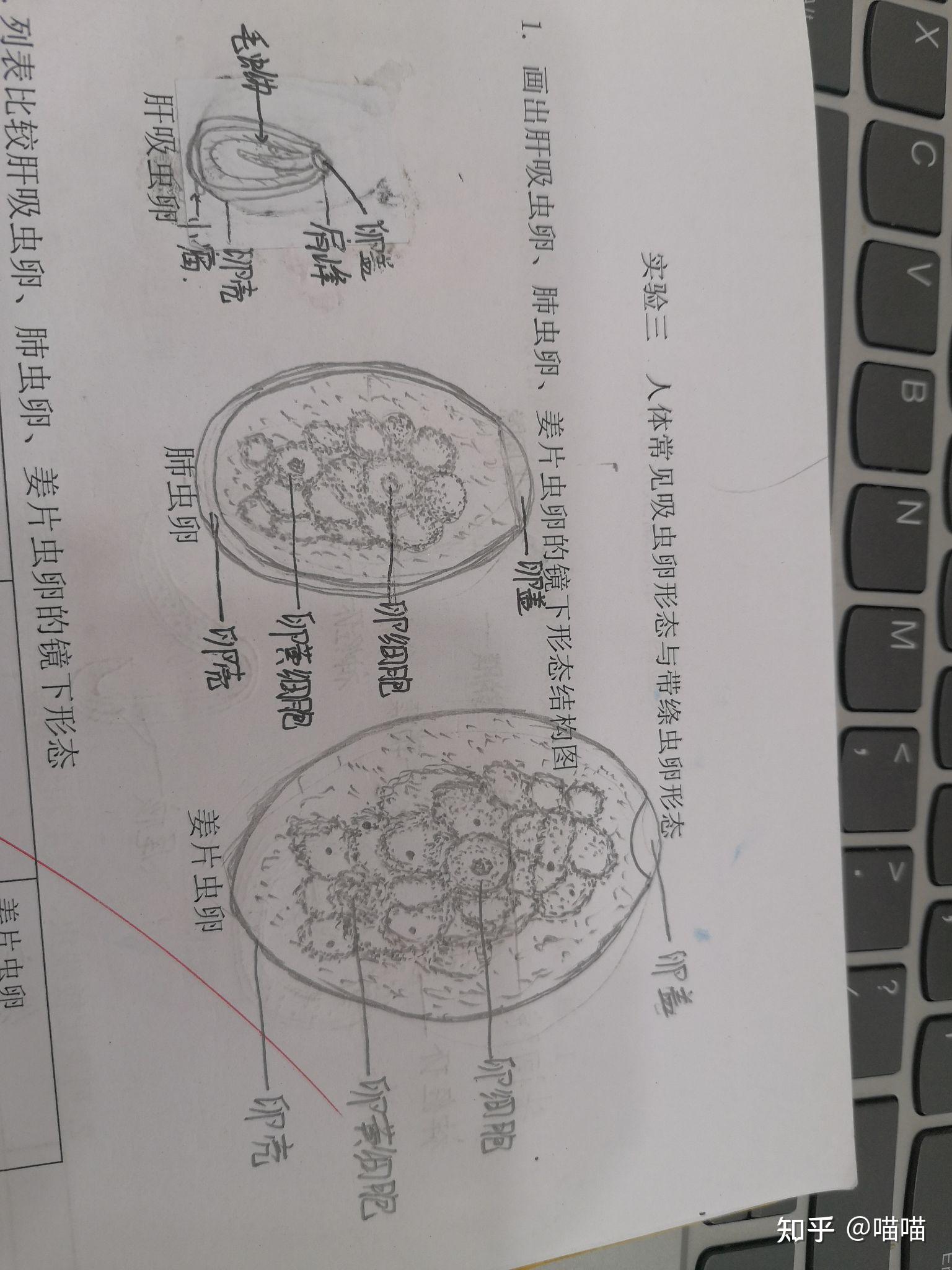 肝吸虫手绘图图片