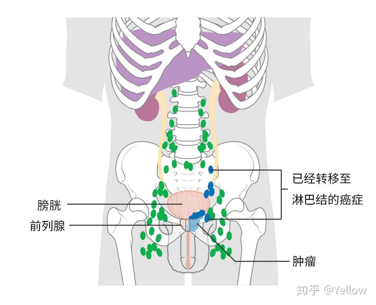 正常颈部、腋窝和腹股沟淋巴结的形态结构 - 知乎