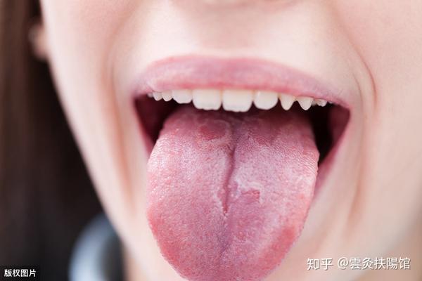 舌头上有这4种情况说明身体向你发出求救信号,别等发病了才后悔 - 知乎