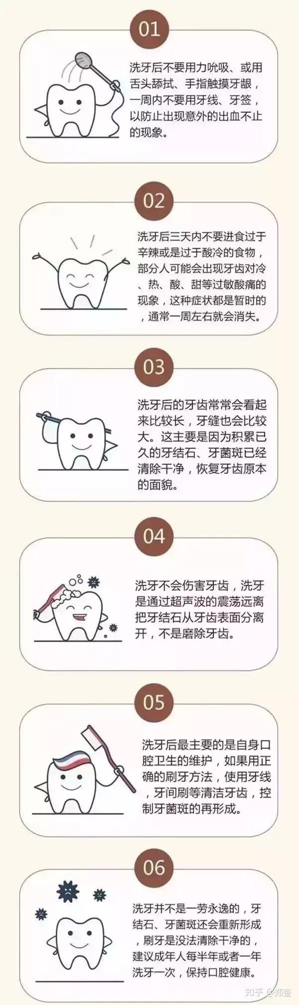 洗牙洗掉的是什么洗牙有什么好处