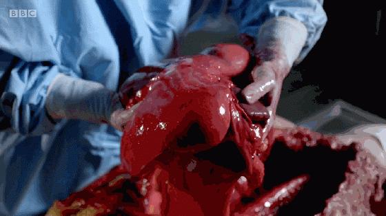 看完这部纪录片你还敢再胖下去