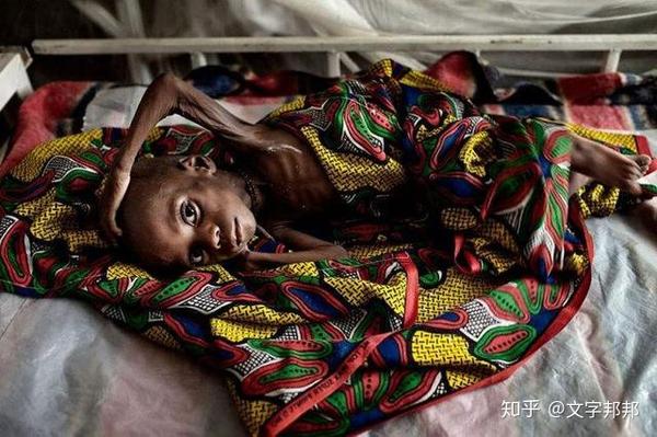 非洲饥民图片图片