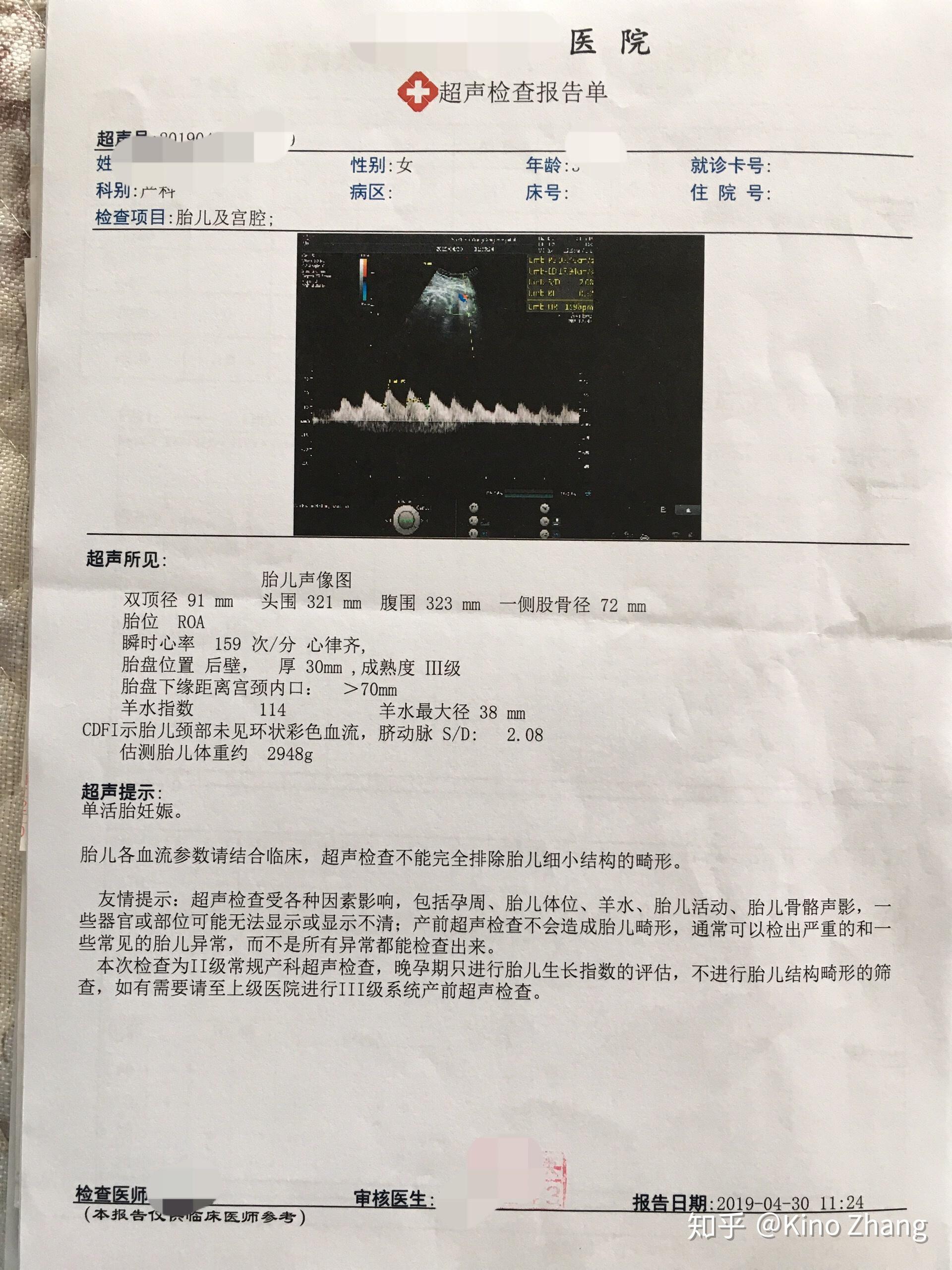 v2-b88922642f344dcd2b24de932766baff_r.jpg
