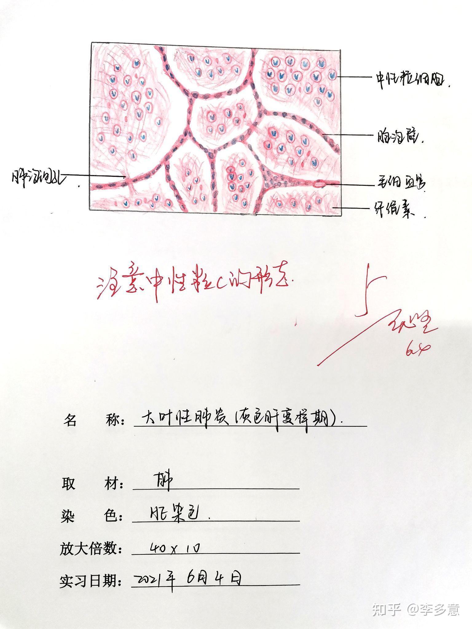 槟榔肝切片绘图图片